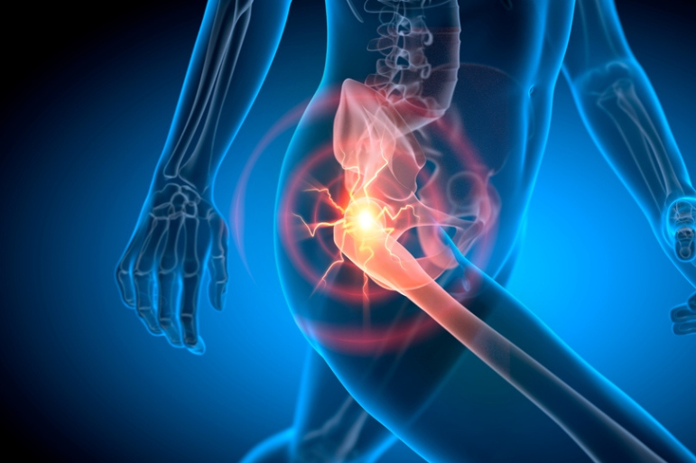 πόνος στο ισχίο