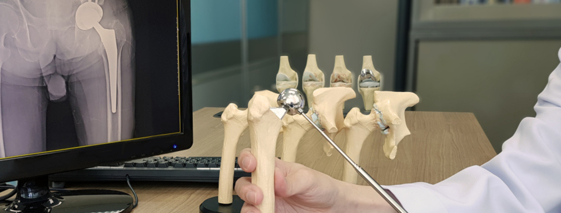 Αναθεώρηση Αρθροπλαστικής